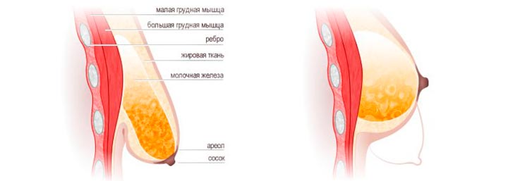 Что такое инволютивные изменения молочных желез? инволюция груди