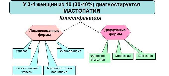 Какая форма мастопатии самая опасная Классификация мастопатии