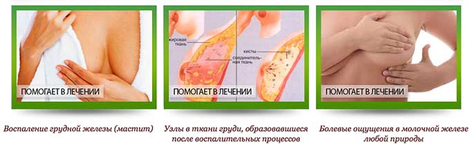 Принцип действия лечебных пластырей Действие мастопатийных пластырей