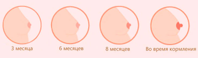 В какой период беременности происходит потемнение сосков Изменения соском на протяжении беременности