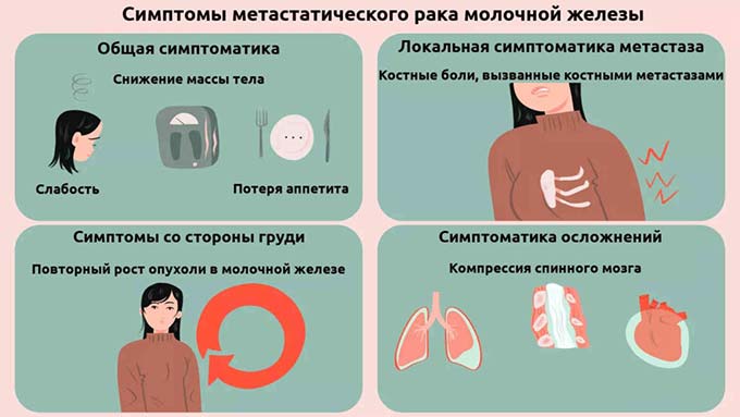 Характер проявляемых симптомов Симптомы метастатического рака груди
