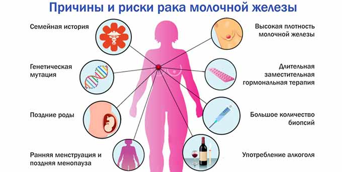 Факторы риска и причины развития заболевания Факторы риска развития рака груди у женщины