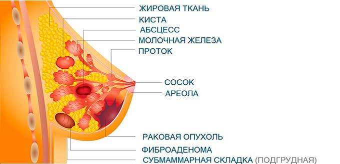 Противопоказания к прохождению физиотерапии Виды образований в молочных железах
