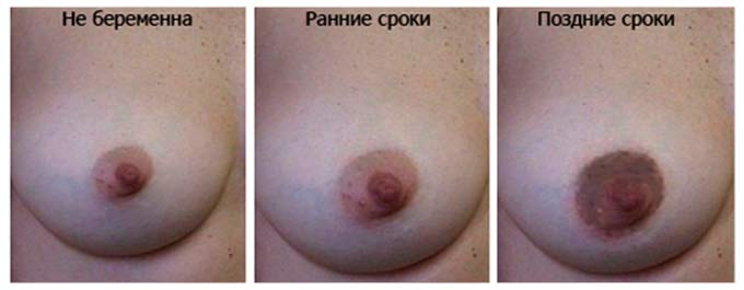 Особенности изменения окраски сосков после наступления зачатия Изменение цвета сосков до и после беременности