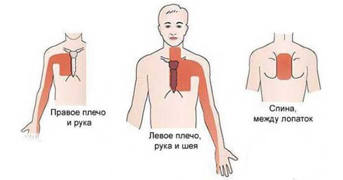 Особенность болезненных ощущений и места их локализации Локализация боли при патологии молочной железы