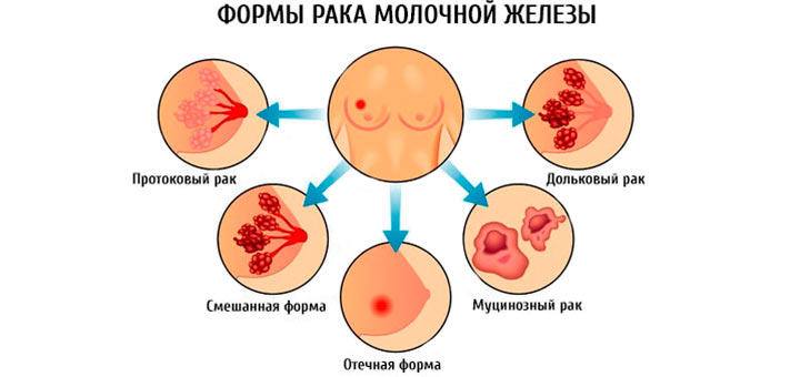 Показания к проведению гормональной терапии формы рмж