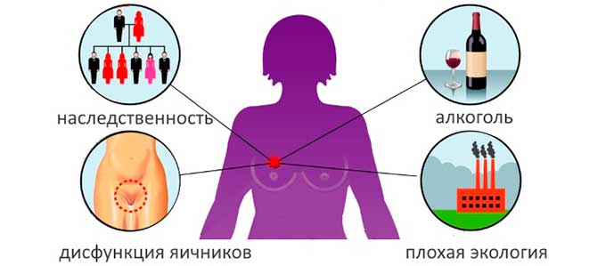 Причины развития патологии Причины развития аденоза груди