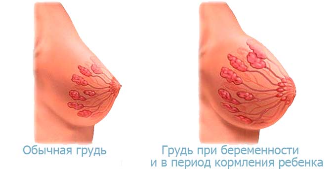 При беременности грудь до и после беременности