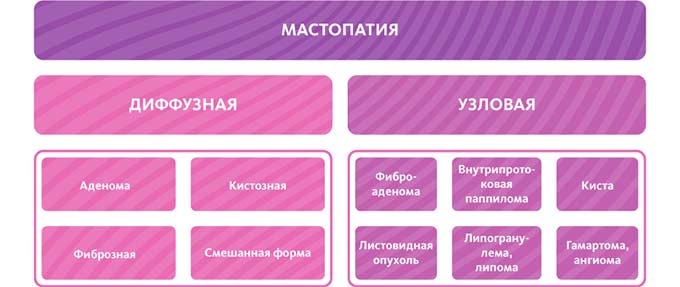 Роль массажа в терапии разных форм мастопатии Разновидности мастопатии