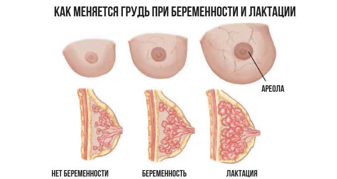 Связь боли с менструаций, беременностью и грудным вскармливанием Изменение груди при беременности и лактации