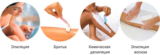 Способы удаления проблемы чрезмерного роста волос Способы удаления волос на теле