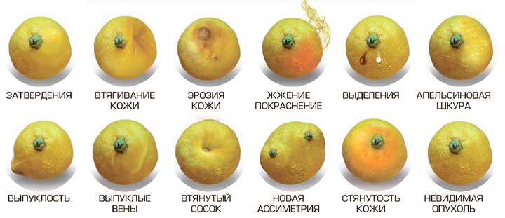 Что должно насторожить? признаки рака