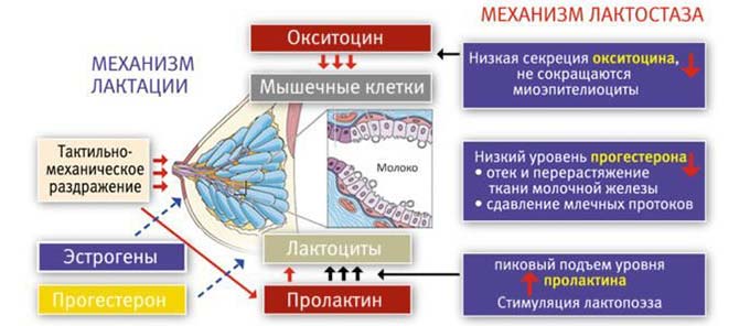 Различия в причинах развития патологий Механизм развития лактостаза