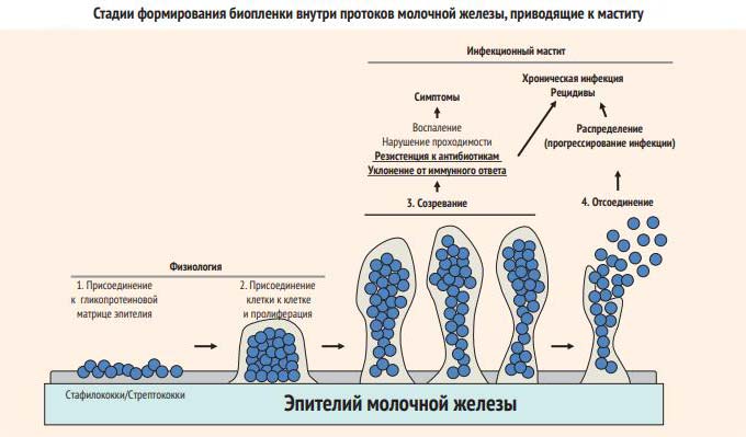Разница в диагностике Механизм развития мастита