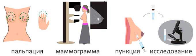 Аппаратная и лабораторная диагностика МЖ Схема диагностики кист молочных желез