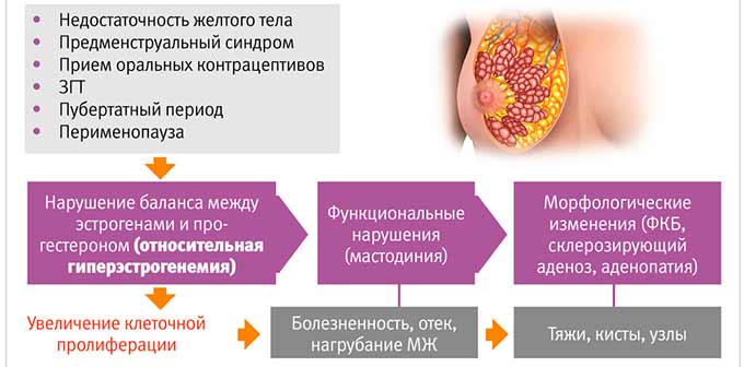 Необычный характер боли в груди Изменения в молочных железах и мастопатия
