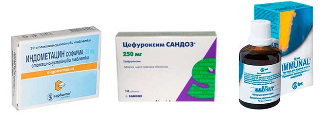 Медикаментозное лечение Индометацин, Цефуроксим и Иммунал