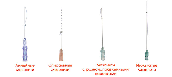 Какие нити используются во время процедуры нити для подтяжки