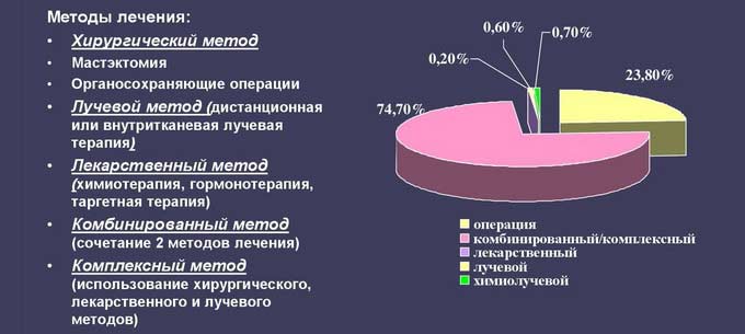 Как проводится лечение рака при метастазах Методы лечения РМЖ