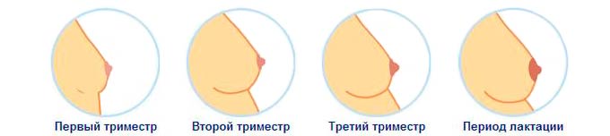 Трудности во время беременности Грудь беременных