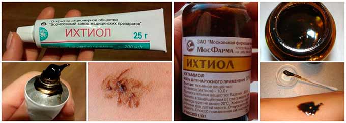 Ихтиоловая мазь Ихтиоловая мазь
