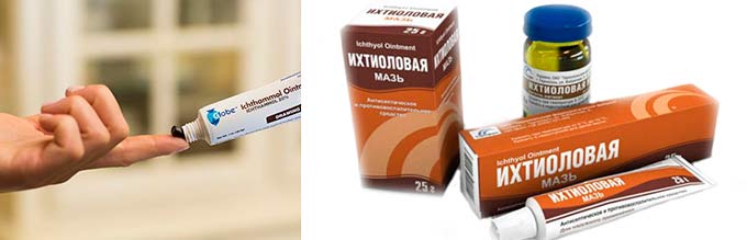 Ихтиоловая мазь