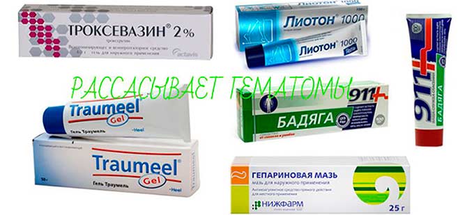 Лечение лекарствами Мази от гематом